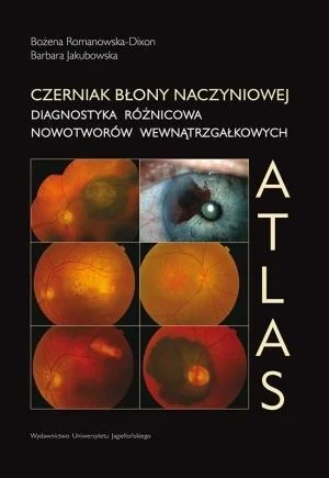 Wybór klientów CZERNIAK BŁONY NACZYNIOWEJ. DIAGNOSTYKA RŹNICOWA