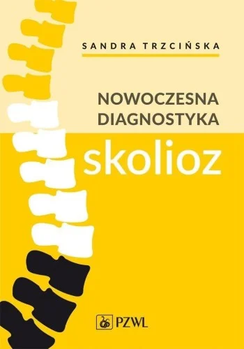 Łatwy zwrot NOWOCZESNA DIAGNOSTYKA SKOLIOZ, SANDRA TRZCI艃SKA