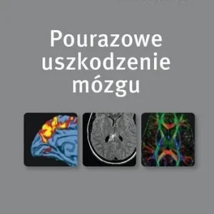 Zamów teraz POURAZOWE USZKODZENIE MZGU