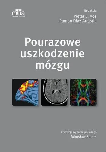 Zamów teraz POURAZOWE USZKODZENIE MZGU